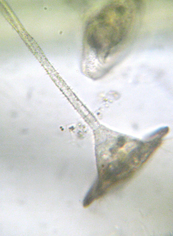 Forse Vorticella patellina